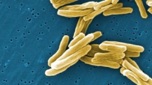 bacteria de la tuberculosis