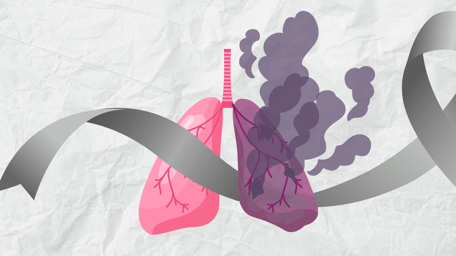 cancer pulmon